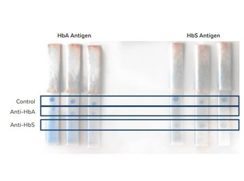 Hemoglobin A (beta chain) Antibody