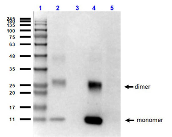 Hemoglobin A (beta chain) Antibody
