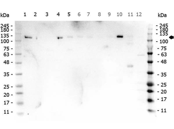 PARP1 (N-term ZF1) Antibody