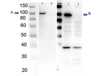 PARP1 (N-term ZF1) Antibody