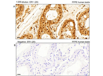 AKT phospho T308 Antibody