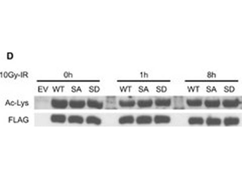 Lysine Acetylated Antibody