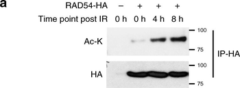 Lysine Acetylated Antibody