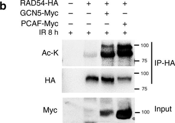 Lysine Acetylated Antibody