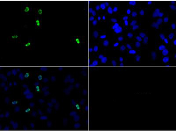 Histone H3 R2me2a Antibody