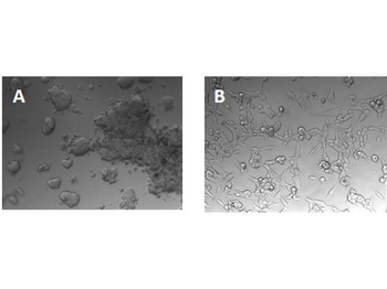 Bovine COL1A1 protein
