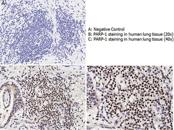PARP1 (N-term ZF1) Antibody Set