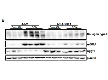 Bovine Collagen Type I protein