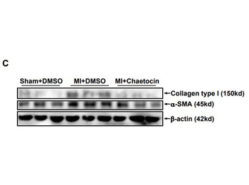 Bovine Collagen Type I protein