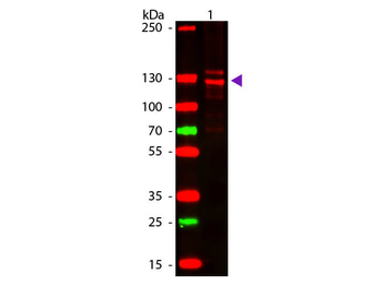Human Collagen Type I protein