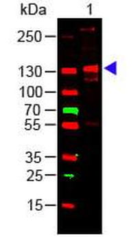 Human Collagen Type III protein
