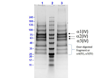 Human Collagen Type IV protein