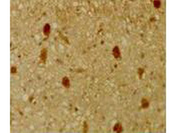 RBL2 Antibody