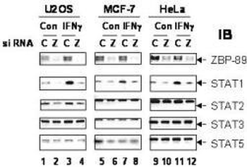ZNF148 Antibody