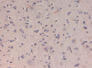KIF5B Antibody
