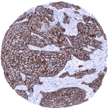 Desmoglein 3 antibody