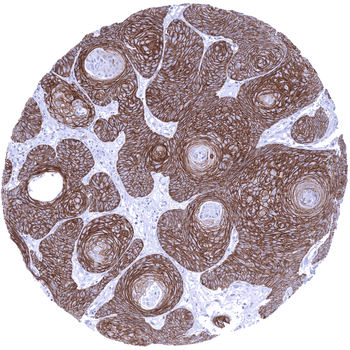 TRIM29 antibody
