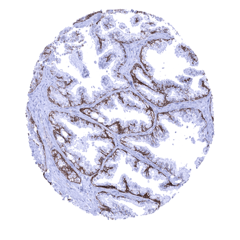 TRIM29 antibody