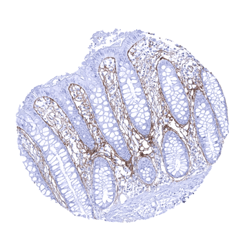 Periostin antibody
