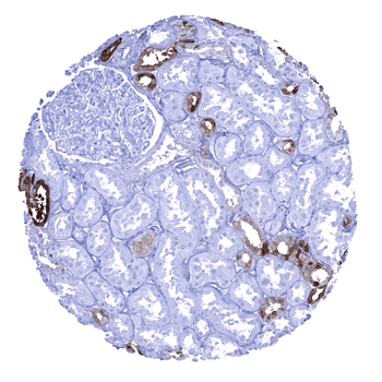 Calbindin 1 antibody