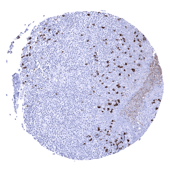 IgA antibody