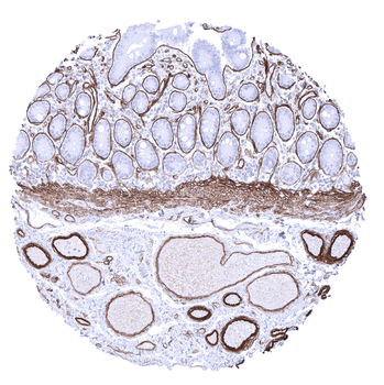Collagen IV antibody