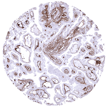Collagen IV antibody