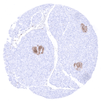 NSE gamma antibody