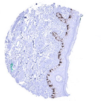 Melan A Specific antibody