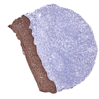 Cytokeratin, Pan antibody