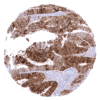 PD-L1 antibody