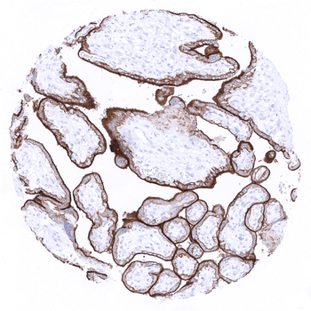 PD-L1 antibody