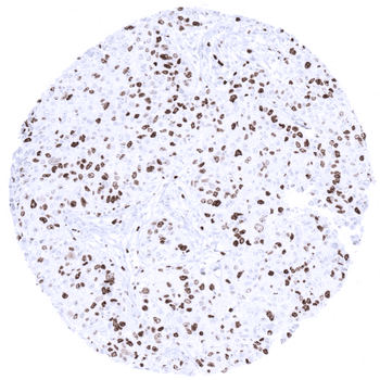 Ki-67 antibody