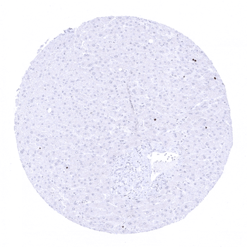 Ki-67 antibody