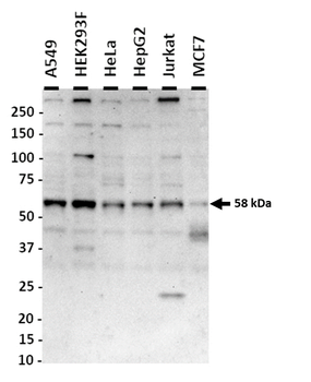 FTO Rabbit Polyclonal Antibody