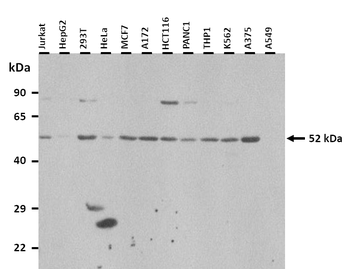 FLJ14768 Rabbit Polyclonal Antibody