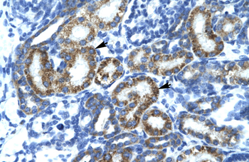 FLJ14768 Rabbit Polyclonal Antibody