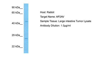 TFAP2A Rabbit Polyclonal Antibody