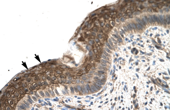 ZFP1 Rabbit Polyclonal Antibody