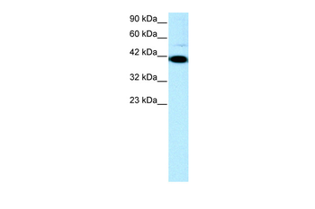 ZFP1 Rabbit Polyclonal Antibody
