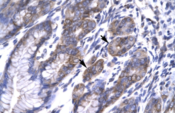 MAP3K7IP2 Rabbit Polyclonal Antibody