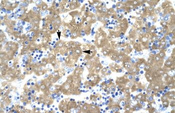 ACAT2 Rabbit Polyclonal Antibody
