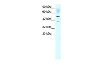 ACAT2 Rabbit Polyclonal Antibody