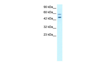 DKFZP761C169 Rabbit Polyclonal Antibody