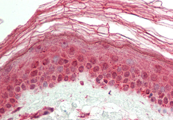 HR Rabbit Polyclonal Antibody