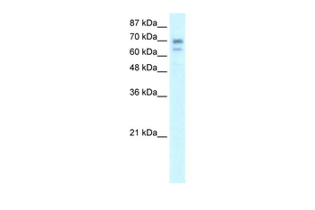 HR Rabbit Polyclonal Antibody