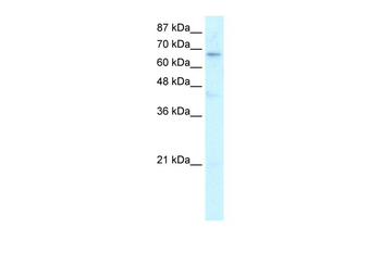 HR Rabbit Polyclonal Antibody