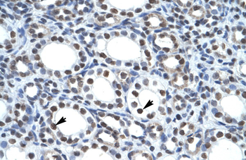 TTRAP Rabbit Polyclonal Antibody