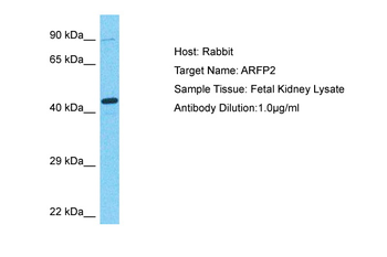 ARFIP2 Rabbit Polyclonal Antibody