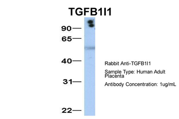 TGFB1I1 Rabbit Polyclonal Antibody